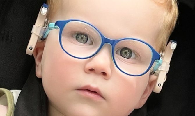 Garso procesorius ir akiniai: nešiojimo galimybės vaikams